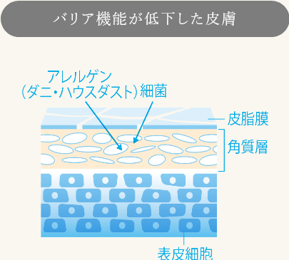 浄水シャワー、塩素、美容、佐賀、アトピー